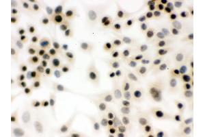 IHC analysis of p95 NBS1 using anti-p95 NBS1 antibody . (Nibrin antibody  (C-Term))