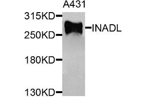 Western blot analysis of extracts of A431 cells, using INADL antibody. (PATJ antibody)