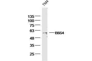 TM4 Mouse Cell lysates probed with BBS4 Polyclonal Antibody, unconjugated  at 1:300 overnight at 4°C followed by a conjugated secondary antibody for 60 minutes at 37°C.