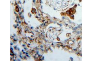 Used in DAB staining on fromalin fixed paraffin-embedded lung tissue (FKBP7 antibody  (AA 20-213))