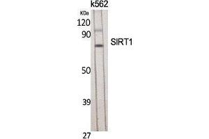 Western Blotting (WB) image for anti-Sirtuin 1 (SIRT1) (Tyr631) antibody (ABIN3186962) (SIRT1 antibody  (Tyr631))