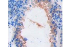 IHC-P analysis of Mouse Tissue, with DAB staining. (ARPC4 antibody  (AA 79-164))