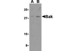 Western Blotting (WB) image for anti-BCL2-Antagonist/killer 1 (BAK1) (N-Term) antibody (ABIN1031258) (BAK1 antibody  (N-Term))