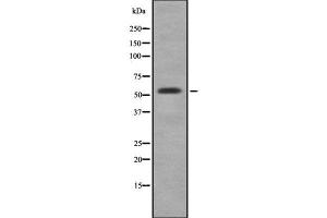 Western blot analysis of CYP3A5 using HepG2 whole cell lysates (CYP3A5 antibody)