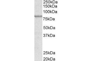 Western Blotting (WB) image for ATP-Binding Cassette, Sub-Family B (MDR/TAP), Member 5 (ABCB5) peptide (ABIN369721) (ATP-Binding Cassette, Sub-Family B (MDR/TAP), Member 5 (ABCB5) Peptide)