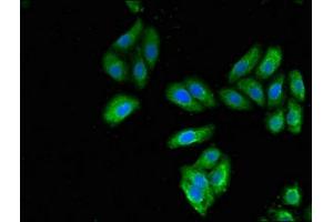 Immunofluorescent analysis of HepG2 cells using ABIN7157444 at dilution of 1:100 and Alexa Fluor 488-congugated AffiniPure Goat Anti-Rabbit IgG(H+L) (Cytokeratin 7 antibody  (AA 2-469))