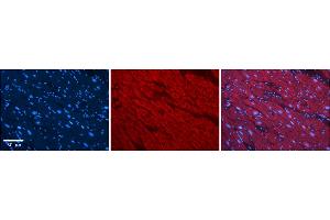 Rabbit Anti-SLC25A12 Antibody    Formalin Fixed Paraffin Embedded Tissue: Human Adult heart  Observed Staining: Cytoplasmic Primary Antibody Concentration: 1:100 Secondary Antibody: Donkey anti-Rabbit-Cy2/3 Secondary Antibody Concentration: 1:200 Magnification: 20X Exposure Time: 0. (SLC25A12 antibody  (Middle Region))