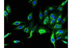 Immunofluorescent analysis of Hela cells using ABIN7158316 at dilution of 1:100 and Alexa Fluor 488-congugated AffiniPure Goat Anti-Rabbit IgG(H+L)
