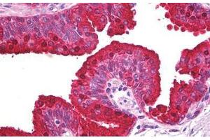 Anti-ABCA5 antibody IHC staining of human prostate.