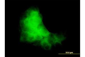 Immunofluorescence of monoclonal antibody to S100A7 on A-431 cell. (S100A7 antibody  (AA 1-101))