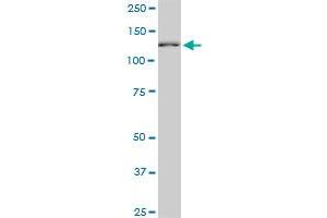 CAND1 monoclonal antibody (M03), clone 2D7. (CAND1 antibody  (AA 1-100))