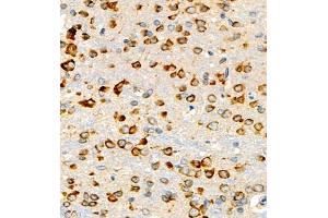 Immunohistochemistry of paraffin embedded mouse brain using P4H (ABIN7074215) at dilution of 1:700 (400x lens) (HIF Prolyl Hydroxylase antibody)