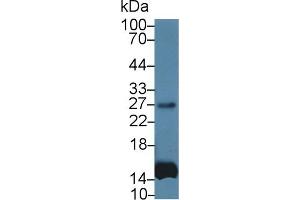 Detection of IL6 in Human Leukocyte lysate using Monoclonal Antibody to Interleukin 6 (IL6) (IL-6 antibody  (AA 27-212))