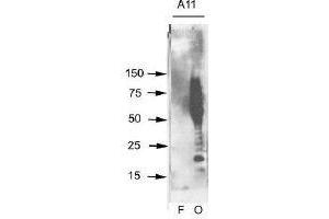 Aβ42 fibrils (F) and prefibrillar oligomers (O) were run on SDS polyacrylamide gels, transferred to nitrocellulose and probed with this antibody (A11). (Amyloid Oligomers antibody)