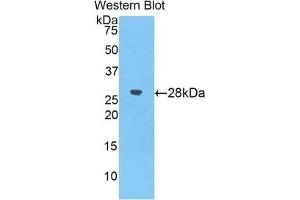 WB of Protein Standard: different control antibodies against Highly purified E. (alpha 2 Macroglobulin ELISA Kit)