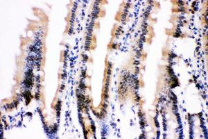 Anti- Ubiquitin Picoband antibody, IHC(P) IHC(P): Mouse Intestine Tissue (Ubiquitin B antibody  (AA 77-152))