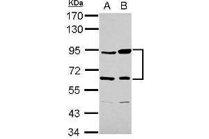 WB Image Sample (30 ug of whole cell lysate) A: Raji B: K562 7. (Complement Factor B antibody)