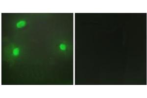 Immunofluorescence analysis of HeLa cells, using FEN1 antibody. (FEN1 antibody  (Internal Region))