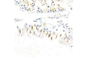 Immunohistochemistry (Paraffin-embedded Sections) (IHC (p)) image for anti-Actin Related Protein 2/3 Complex, Subunit 1B, 41kDa (ARPC1B) antibody (ABIN7072895)