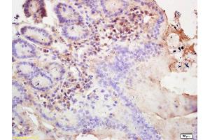 Formalin-fixed and paraffin embedded mouse intestine labeled with Rabbit Anti SSA/52KDa RoPolyclonal Antibody, Unconjugated (ABIN671196) at 1:200 followed by conjugation to the secondary antibody and DAB staining (TRIM21 antibody  (AA 301-400))