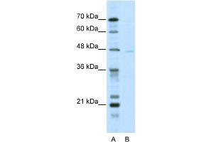 WB Suggested Anti-TRIM38 Antibody Titration:  5. (TRIM38 antibody  (N-Term))