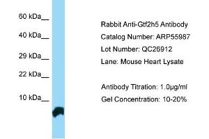 Western Blotting (WB) image for anti-General Transcription Factor IIH, Polypeptide 5 (GTF2H5) (N-Term) antibody (ABIN970845) (GTF2H5 antibody  (N-Term))