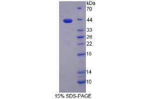 Image no. 1 for Histone Deacetylase 9 (HDAC9) (AA 23-343) protein (His tag) (ABIN4990327) (HDAC9 Protein (AA 23-343) (His tag))