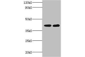 Western blot All lanes: GLT8D2 antibody at 2 μg/mL Lane 1: Mouse heart tissue Lane 2: Mouse kidney tissue Secondary Goat polyclonal to rabbit IgG at 1/10000 dilution Predicted band size: 41 kDa Observed band size: 41 kDa (GLT8D2 antibody  (AA 25-349))