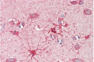 ABIN1590086 (5µg/ml) staining of paraffin embedded Human Cortex. (CROT antibody  (AA 178-199))