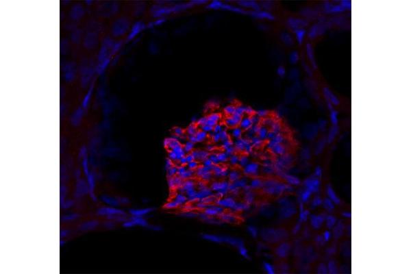 SYNPO antibody  (Isoform 2)