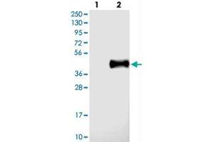 Western blot analysis of Lane 1: Negative control (vector only transfected HEK293T lysate), Lane 2: Over-expression Lysate (Co-expressed with a C-terminal myc-DDK tag (~3. (IL22RA2 antibody)