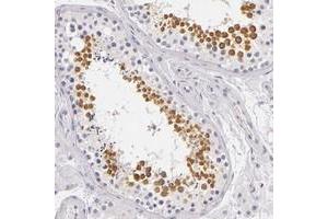 Immunohistochemical staining of human testis with FAM181A polyclonal antibody  shows distinct cytoplasmic positivity in cells in seminiferus ducts. (FAM181A antibody)