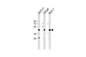 Western Blot at 1:2000 dilution Lane 1: 293T/17 whole cell lysate Lane 2: LNCaP whole cell lysate Lane 3: MCF-7 whole cell lysate Lysates/proteins at 20 ug per lane. (PRMT6 antibody  (N-Term))