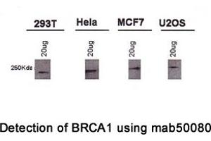 Image no. 4 for anti-Breast Cancer 1 (BRCA1) (AA 1314-1600), (AA 1314-1864) antibody (ABIN363234) (BRCA1 antibody  (AA 1314-1600, AA 1314-1864))