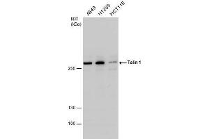 WB Image Talin 1 antibody detects Talin 1 protein by western blot analysis.