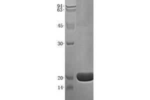 Validation with Western Blot (AGR3 Protein (His tag))