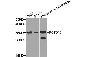 Western blot analysis of extracts of various cell lines, using KCTD15 antibody. (KCTD15 antibody)