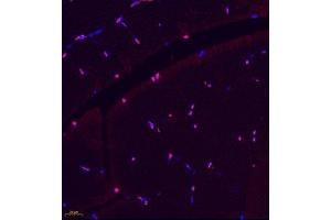 Immunofluorescence of paraffin embedded rat skeletal muscle using BCMA (ABIN7076067) at dilution of 1: 600 (400x lens) (BCMA antibody)