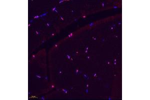 Immunofluorescence of paraffin embedded rat skeletal muscle using BCMA (ABIN7076067) at dilution of 1: 600 (400x lens) (BCMA antibody)