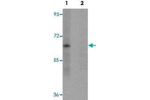 Western blot analysis of mouse lung tissue with ZSCAN4 polyclonal antibody  in (Lane 1) the absence and (Lane 2) presence of peptide blocking. (ZSCAN4 antibody  (C-Term))