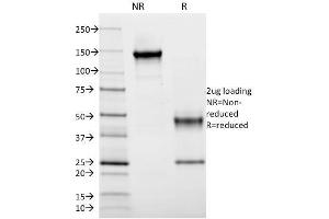 SDS-PAGE Analysis Purified HLA-DR Mouse Monoclonal Antibody (DA2). (HLA-DRB1 antibody)