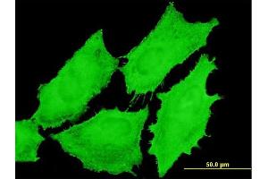 Immunofluorescence of monoclonal antibody to EMR4P on HeLa cell. (EMR4P antibody  (AA 21-93))
