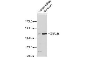 Western blot analysis of extracts of various cell lines, using ZNF268 antibody (ABIN6133062, ABIN6150485, ABIN6150486 and ABIN6216704) at 1:3000 dilution. (ZNF268 antibody  (AA 1-270))