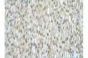 Immunohistochemistry (IHC) image for anti-SRA Stem-Loop Interacting RNA Binding Protein (SLIRP) (N-Term) antibody (ABIN2776583)