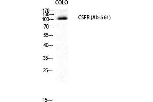 Western Blot (WB) analysis of COLO205 cells using c-Fms Polyclonal Antibody. (CSF1R antibody  (Ser274))