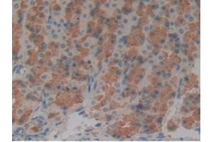 Immunohistochemistry (IHC) image for anti-Microtubule-Associated Protein tau (MAPT) (AA 34-368) antibody (ABIN7434482)