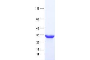 Validation with Western Blot (CDCA4 Protein (His tag))