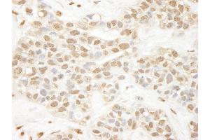 anti-Proprotein Convertase Subtilisin/kexin Type 2 (PCSK2) (AA 150-200) antibody