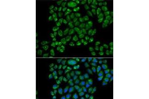Immunofluorescence analysis of HeLa cells using GRIA3 Polyclonal Antibody (Glutamate Receptor 3 antibody)