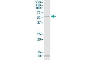 PNKP polyclonal antibody (A01). (PNKP antibody  (AA 422-521))